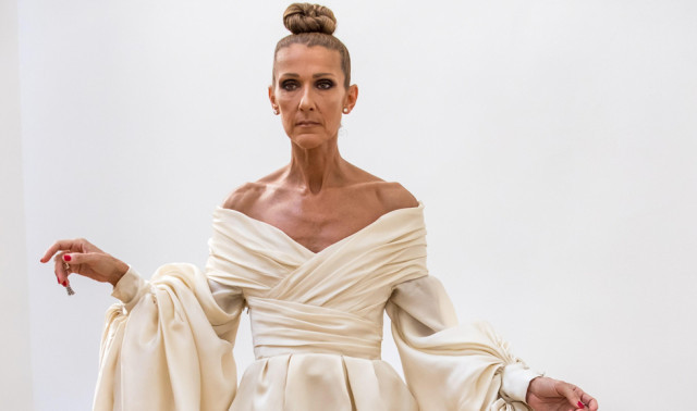 Céline Dion ha perdido el control de sus músculos por culpa de su