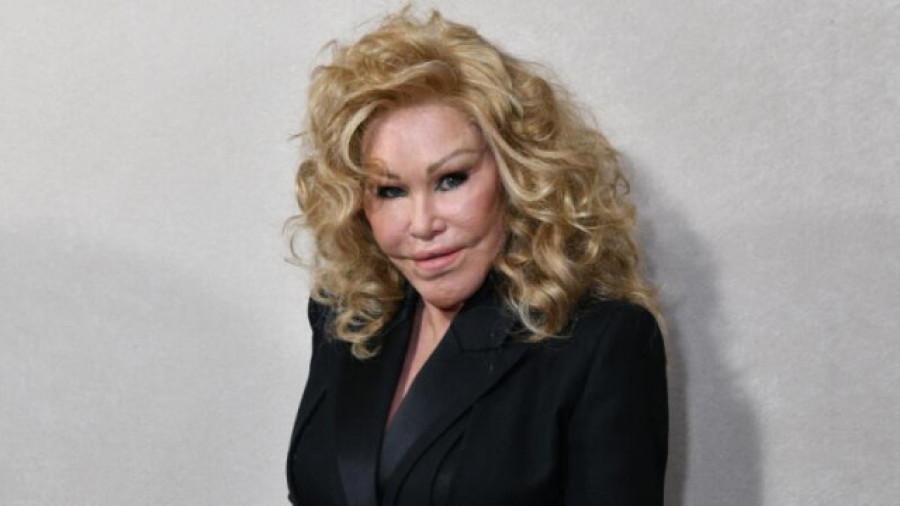 Fallece Jocelyn Wildenstein, famosa por sus extremas cirugías y conocida como 'Catwoman'